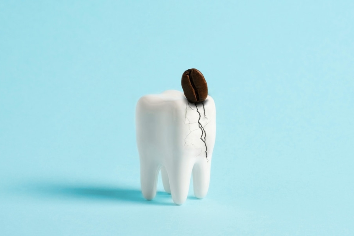 Cracked Teeth Westwood